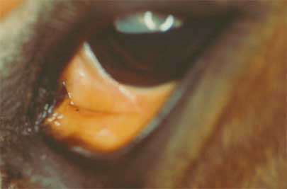 Signs of Liver damage